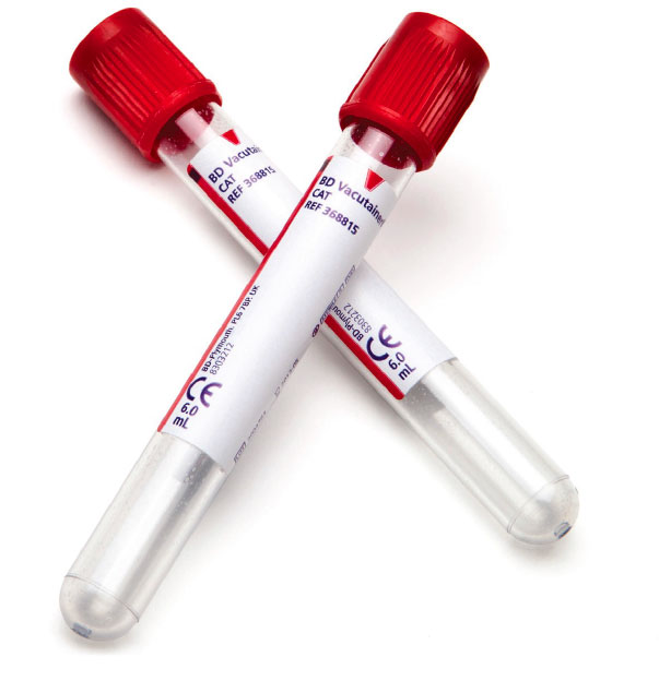 Zkumavky pro analýzu séra