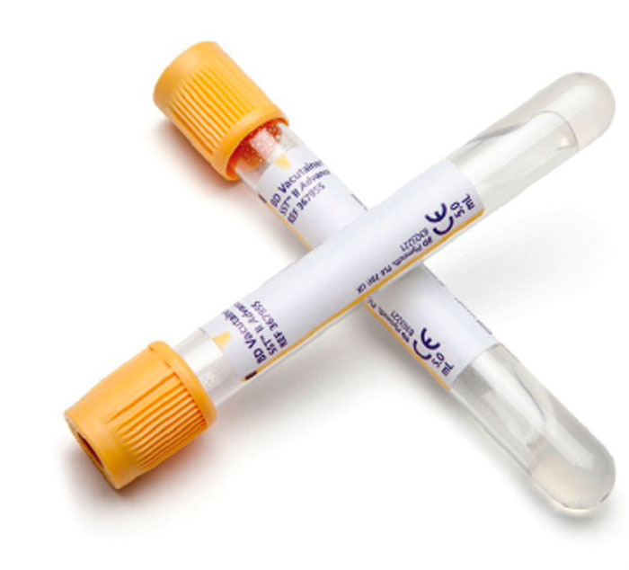 Zkumavky pro separaci séra - BD SST™ II Advance