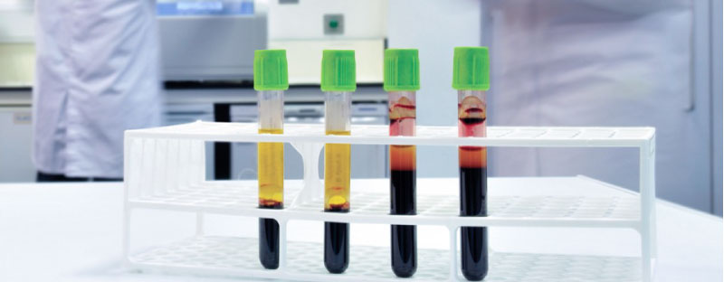 Zkumavky pro separaci plazmy – Barricor™